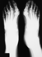 Podiatry New Windsor